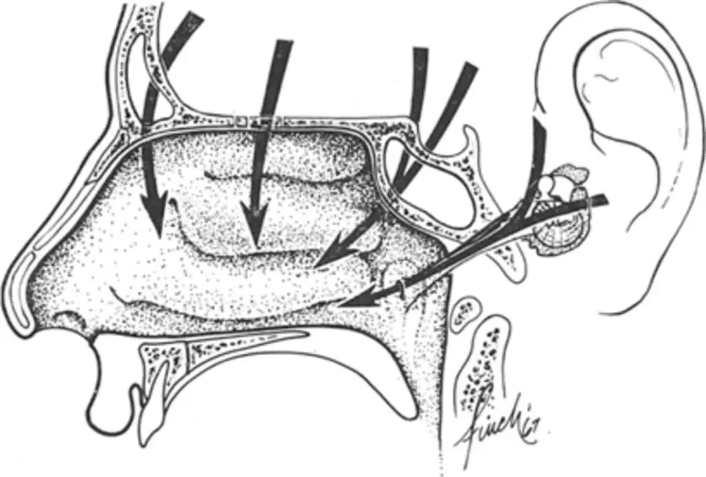 Pathways of the csf rhinorrhea